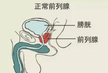 前列腺解剖示意图-前列腺解剖示意图 分区