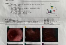 免疫力检查多少钱-免疫力检查多少钱当天能出结果吗