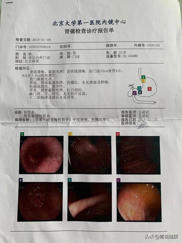 免疫力检查多少钱-免疫力检查多少钱当天能出结果吗