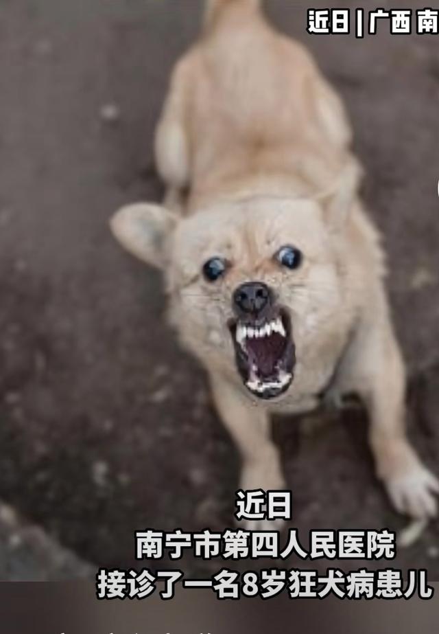 狂犬病患者-狂犬病患者的口水会传染吗